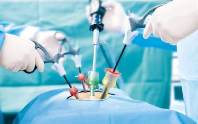 Why Laparoscopy
