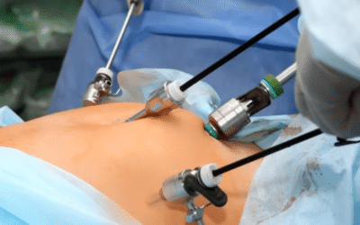 Laparoscopic Surgeon in Gorakhpur