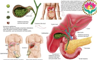 Gallbladder Surgery Specialist in Gorakhpur